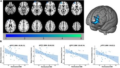 Obesity, Psychological Distress, and Resting State Connectivity of the Hippocampus and Amygdala Among Women With Early-Stage Breast Cancer